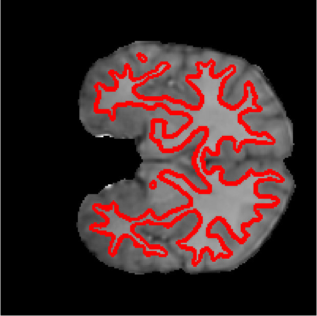 Figure 29